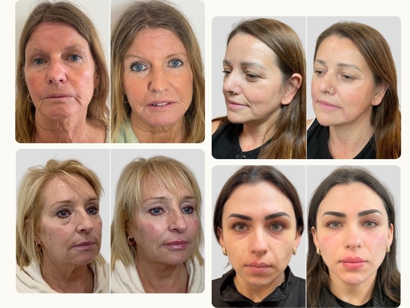 aesthetics-kings-cross-results