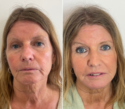 aesthetics-transformations-anti-ageing