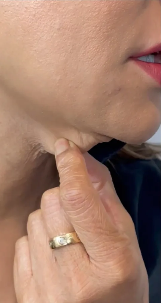 Before polynucleotides, neck